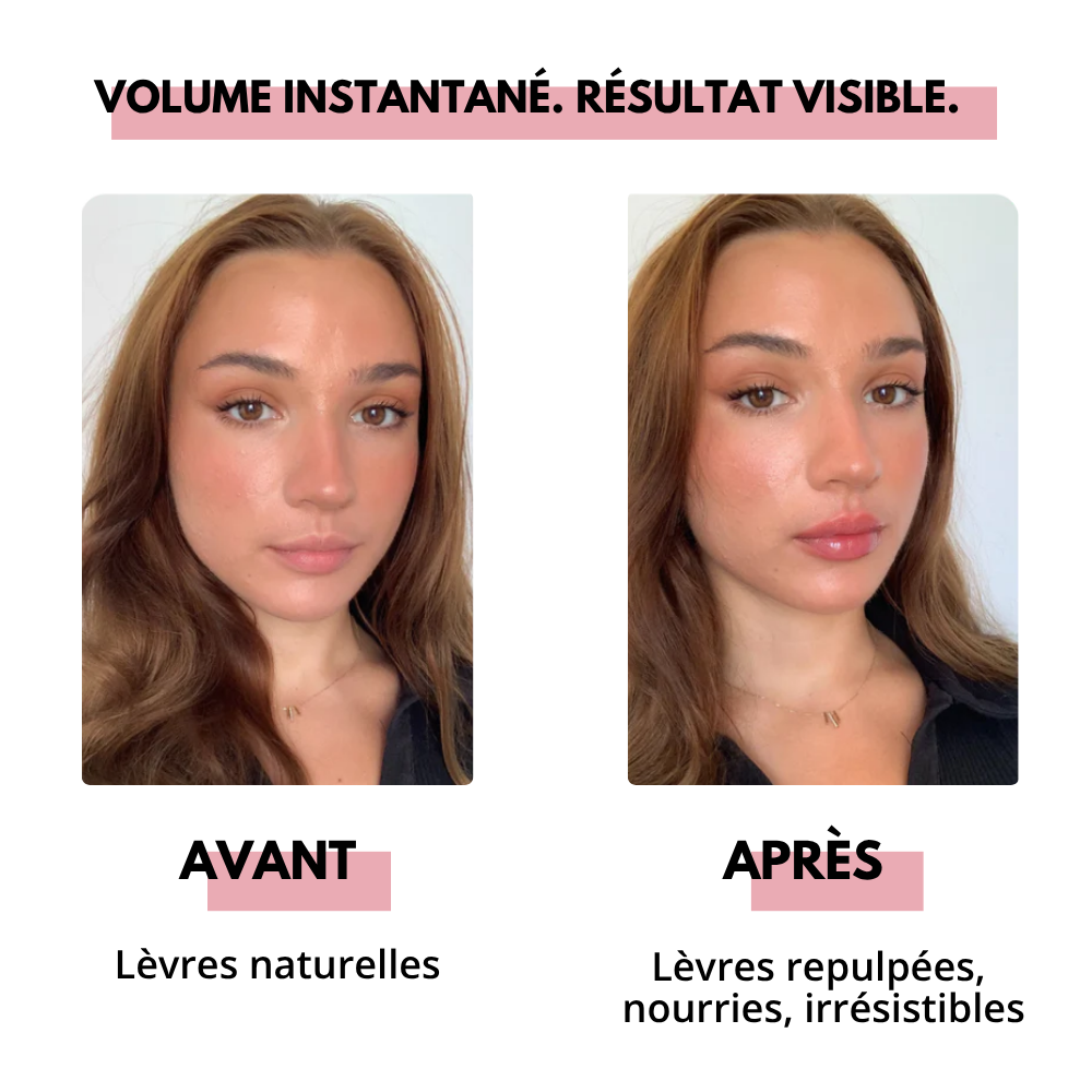 Soin Repulpant Lèvres Ntaller