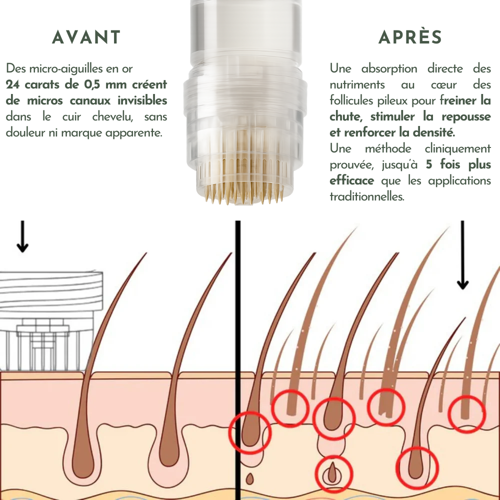 Micro-infusion Capillaire Homme– Repousse & Densité